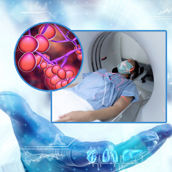 Do mắc các bệnh lý tự miễn